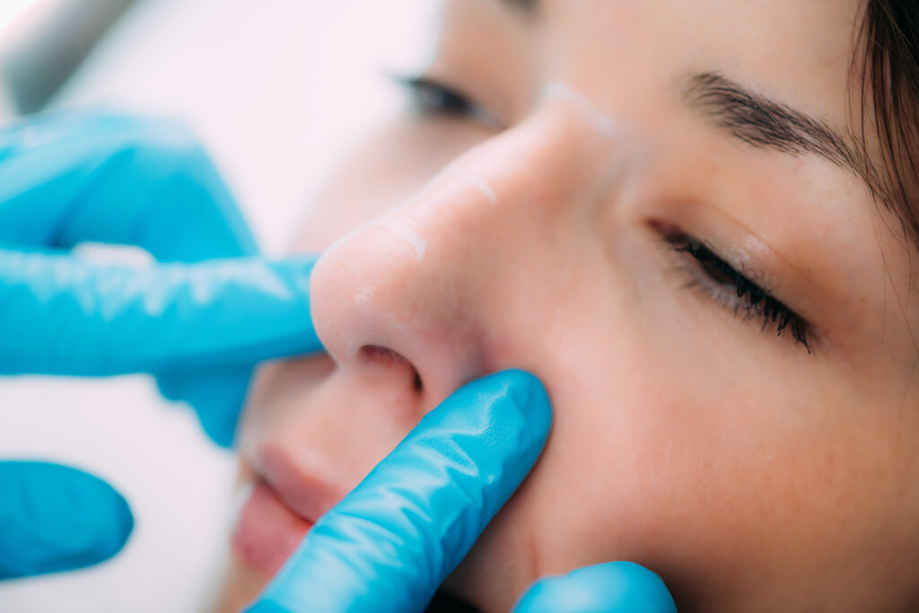 Are You a Good Candidate for Nose Job Surgery?