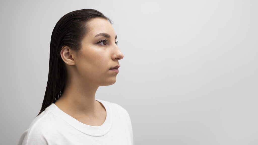 Droopy Nose: Causes, Issues & Treatment Options 2 Droopy Nose: Causes, Issues & Treatment Options