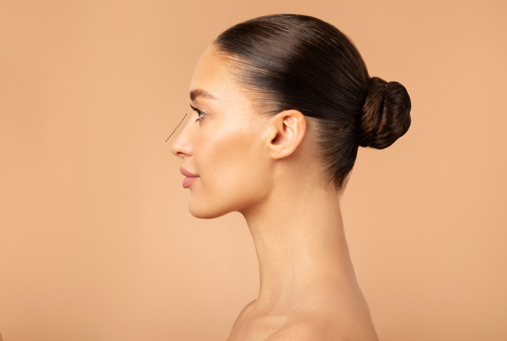 What Is Ultrasonic Rhinoplasty? 3 What Is Ultrasonic Rhinoplasty?