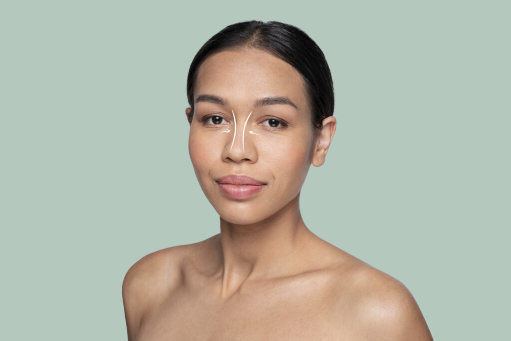 Summer and Nose Surgery: What You Need to Know Before Summer 3 Summer and Nose Surgery: What You Need to Know Before Summer