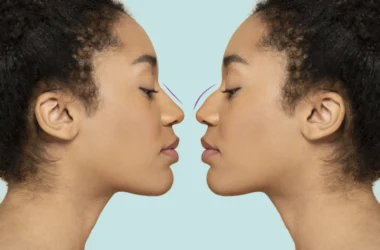 best rhinoplasty surgeons in turkey
