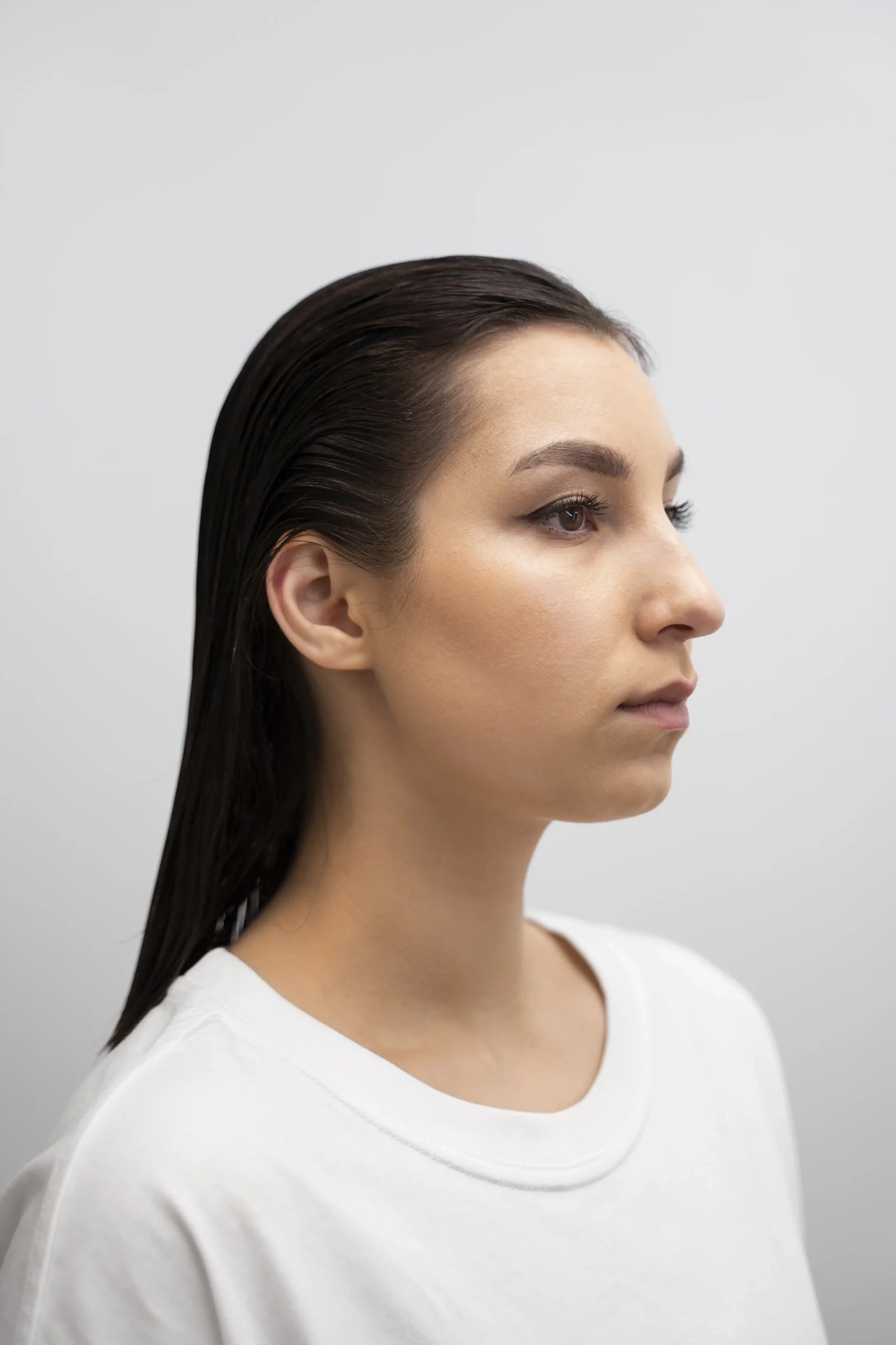nose job cost turkey