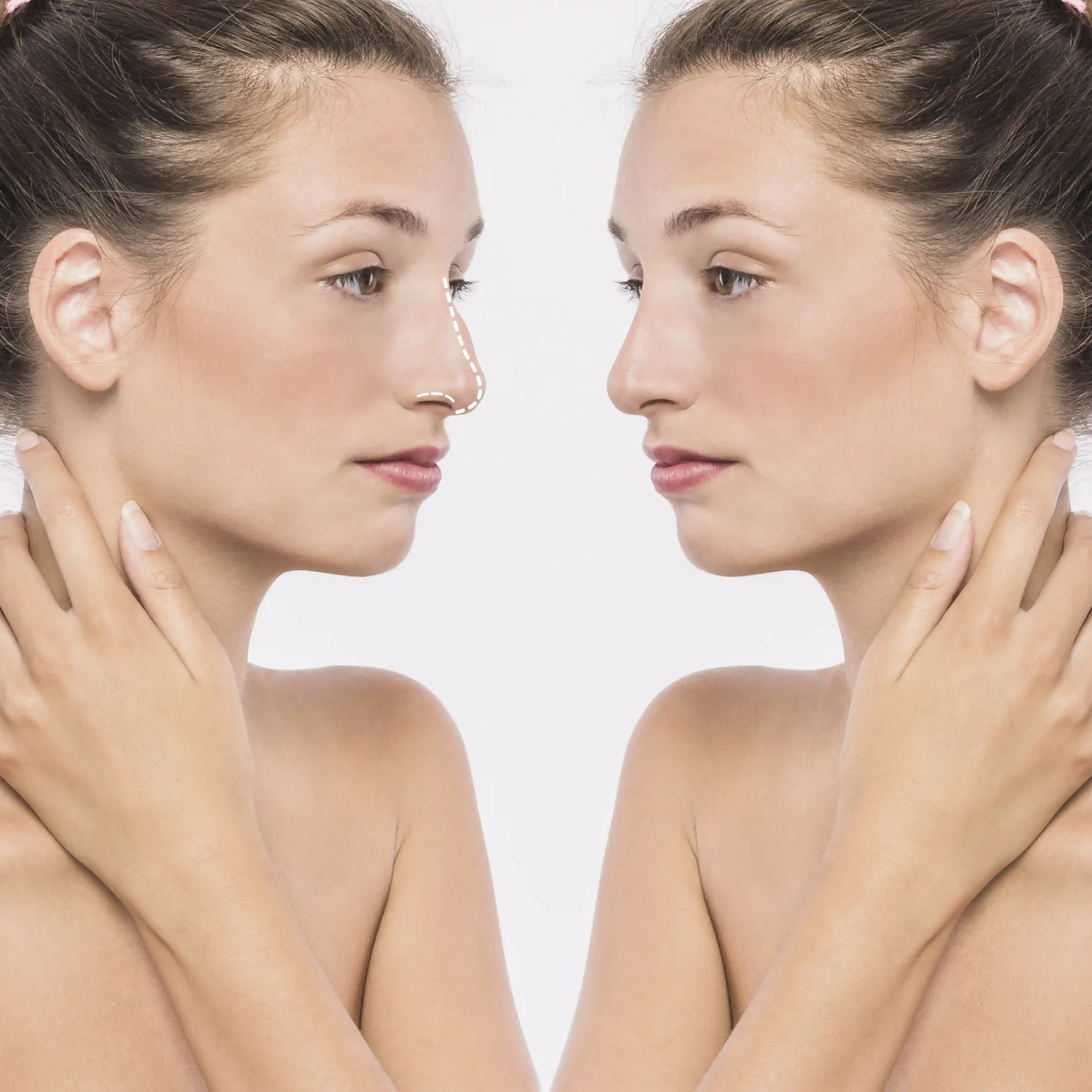 scams to avoid for rhinoplasty in turkey