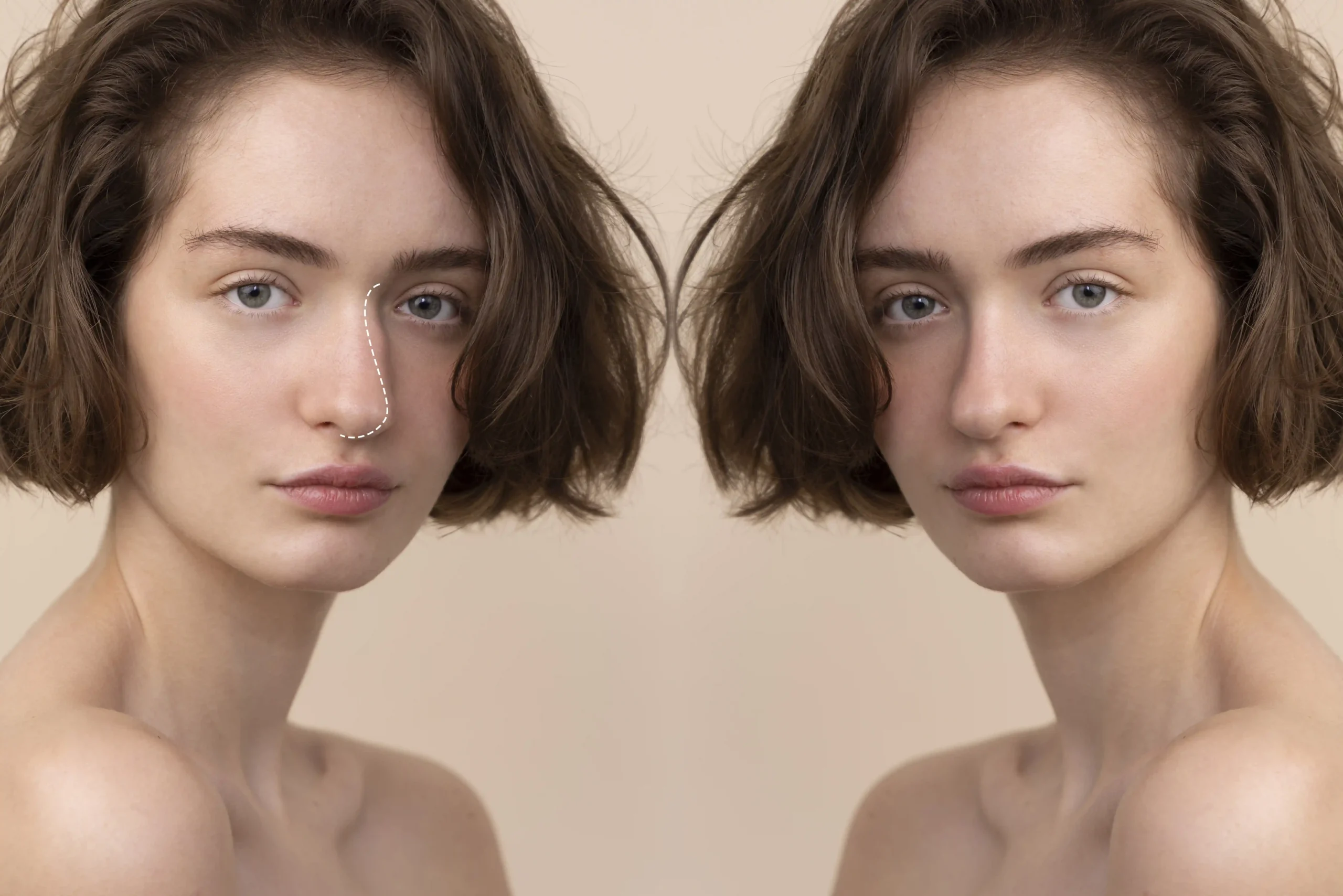 turkey nose job consultation